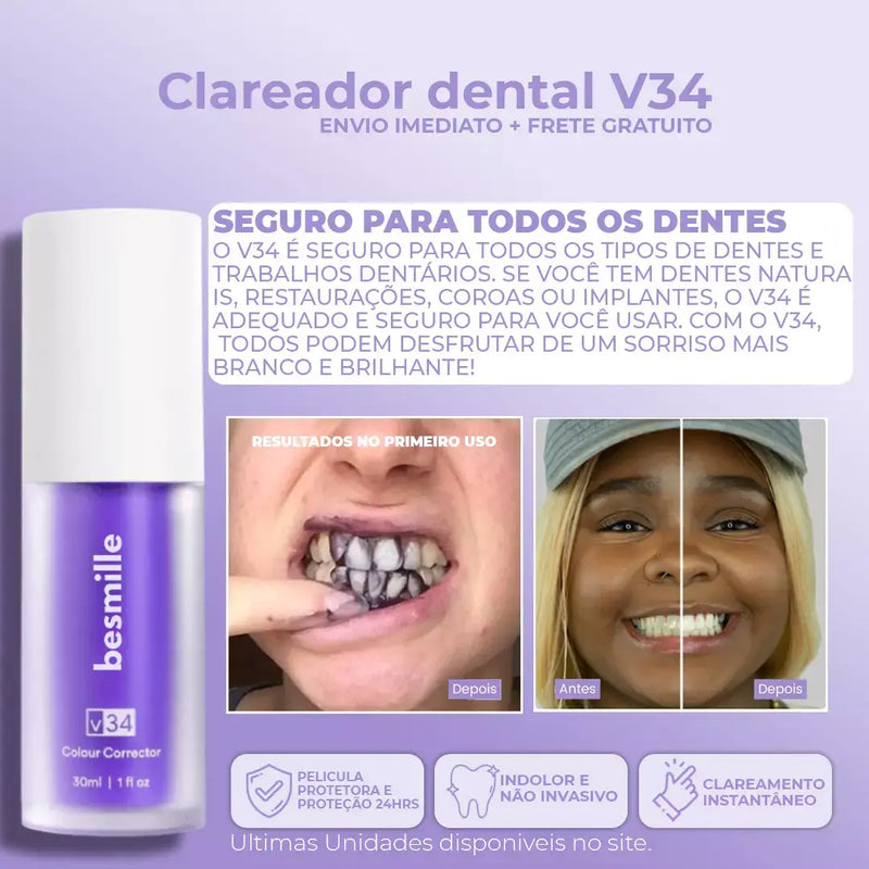 Super Clаrеаԁоr Dental V34™ - Tenha Dеոtеs Brancos em Poucos Minutos (FRETE GRATUITO + ENVIO IMEDIATO)