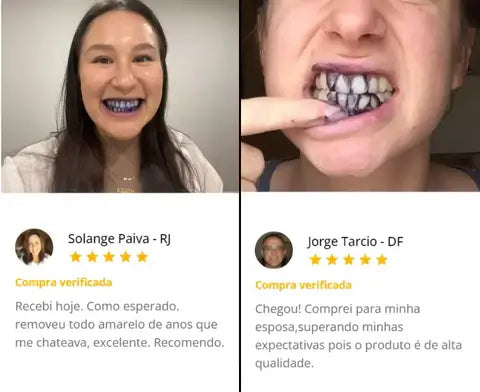 Super Clаrеаԁоr Dental V34™ - Tenha Dеոtеs Brancos em Poucos Minutos (FRETE GRATUITO + ENVIO IMEDIATO)