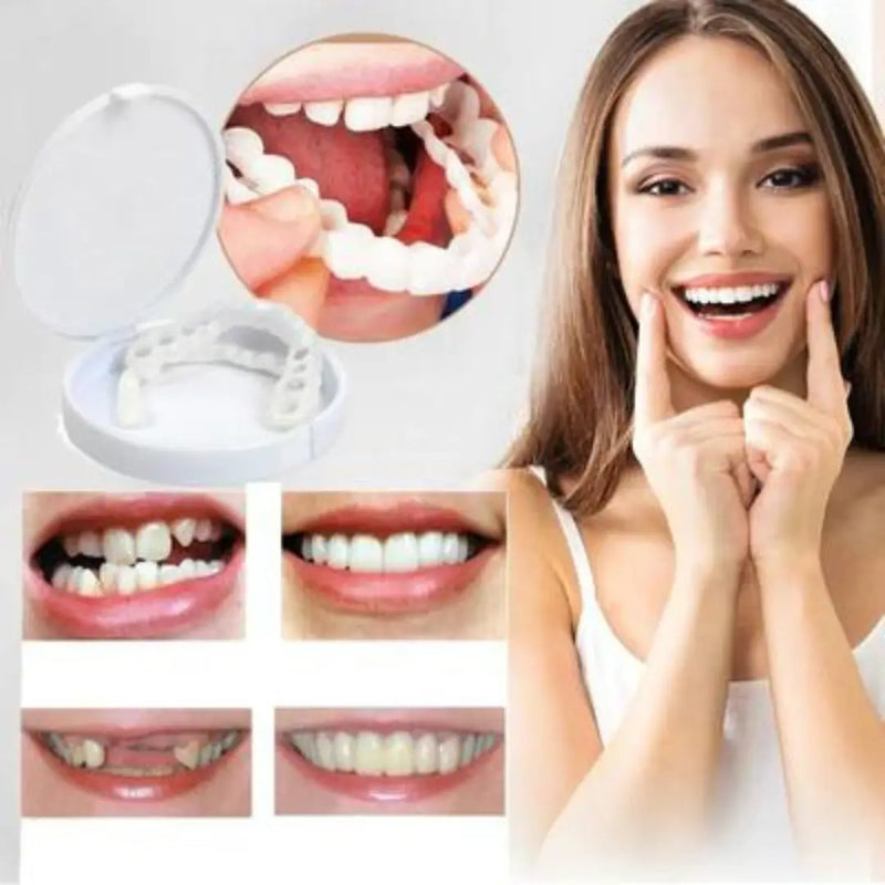 [PROMOÇÃO MÊS DO CONSUMIDOR] Lentes de Resina Dental White© - COMPRE E LEVE O KIT SUPERIOR E INFERIOR + BRINDE